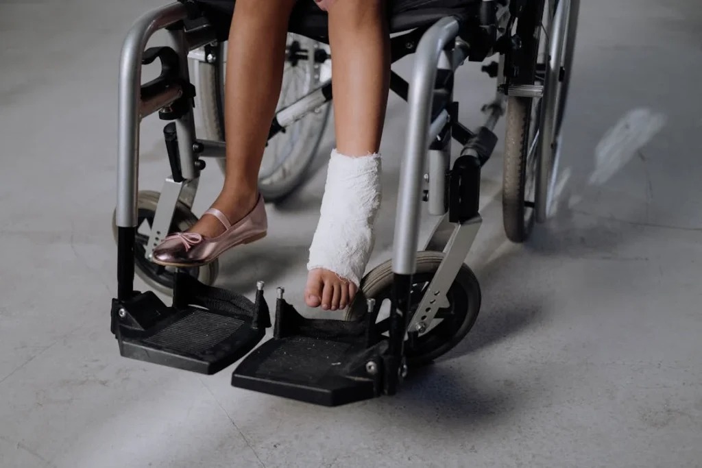 Delhi High Court Enhances Motor Accident Compensation to ₹76.4 Lakh, Recognizes Lifelong Prosthetic Limb Needs