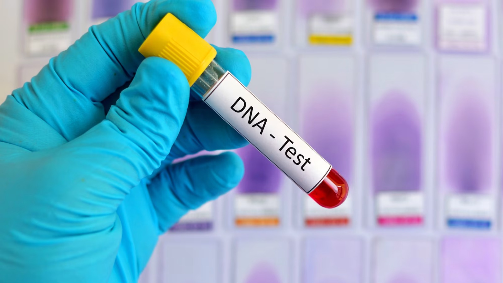 Madhya Pradesh High Court Allows DNA Test of Child to Prove Wife’s Adultery