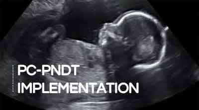 Why Misuse of Portable Ultrasound Machines for Sex Determination Can Land You in Jail