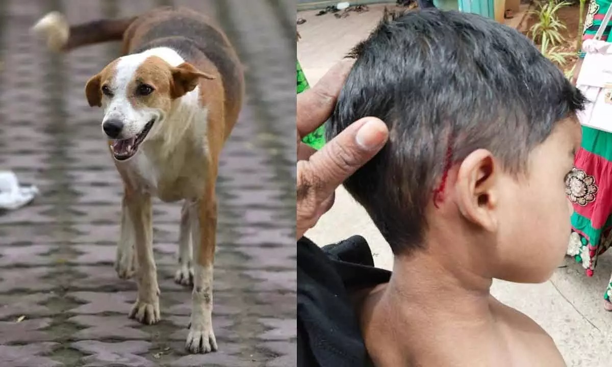 Supreme Court Slams Authorities Over Stray Dog Attacks: Calls for Strict Enforcement of Rules to Protect Citizens